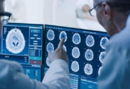 Tata Elxsi, Bayer Launch Radiology Innovation Centre